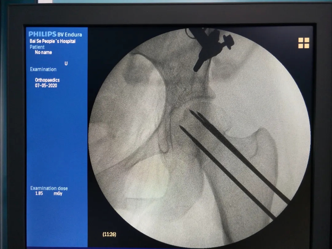 1594106399400990.jpg 640.webp.jpg