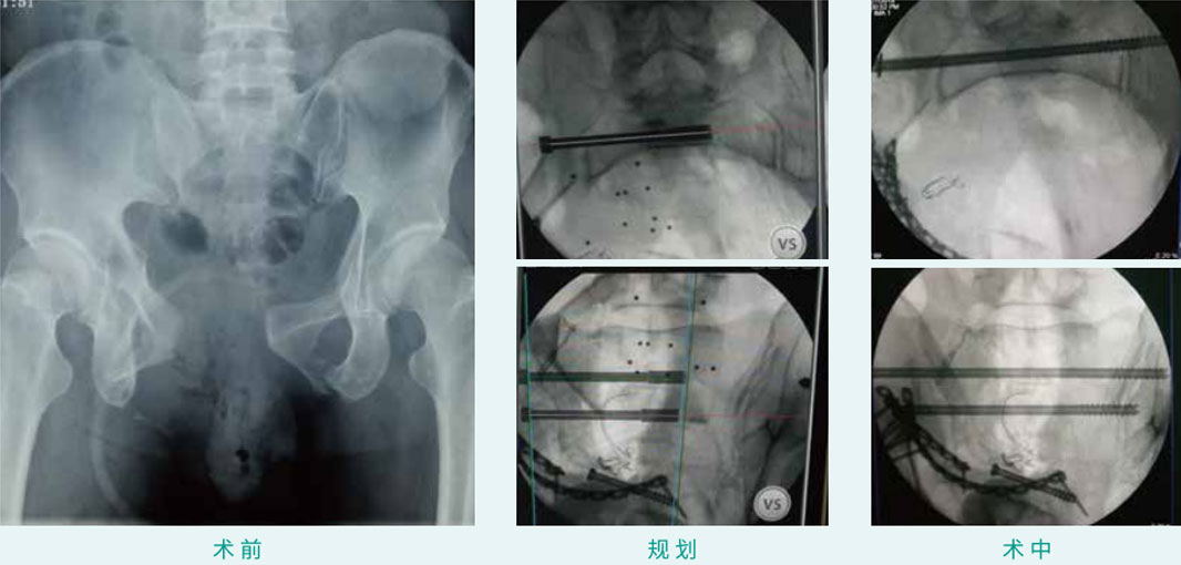 1590383844889043.jpg 17-1.jpg