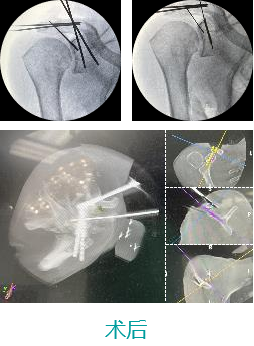 1642582353888104.png image.png